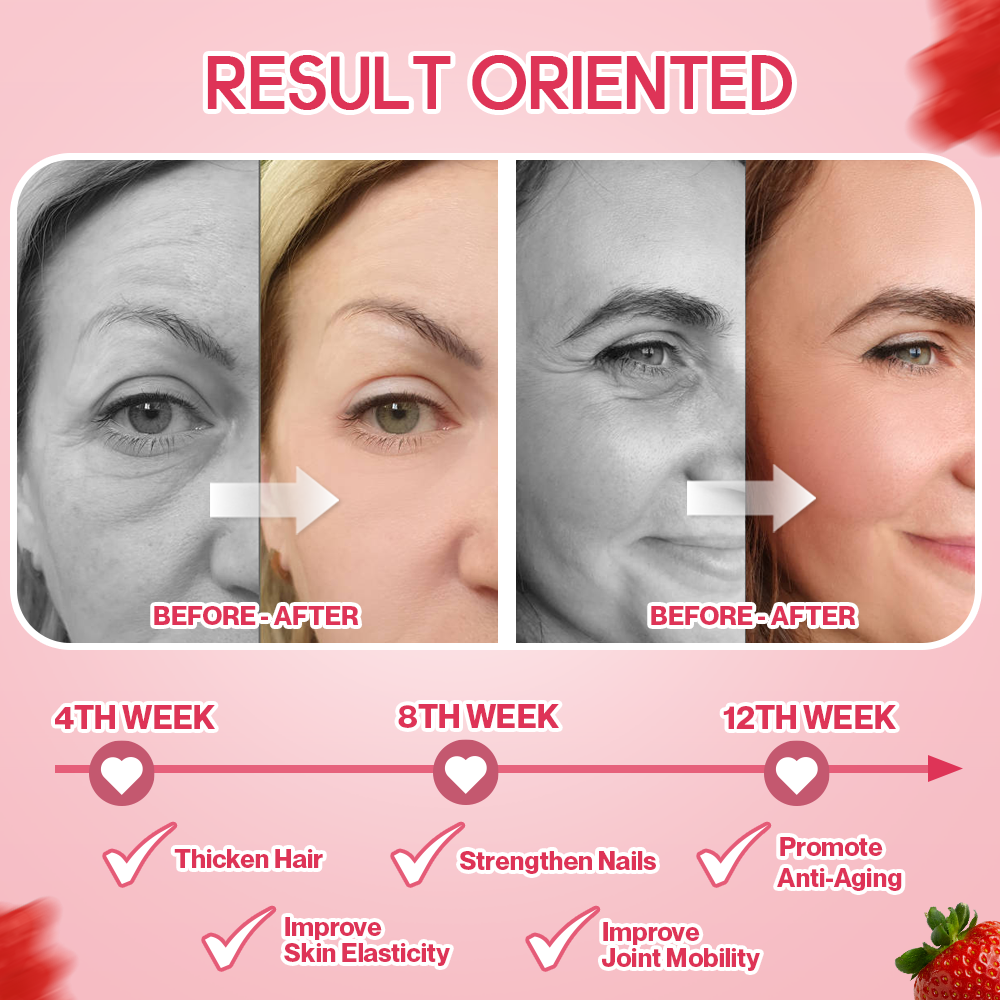 Daynee Collagen Gummies | Dietary Supplement for Collagen Replenishment and Hair/Nails/Skin Improvement