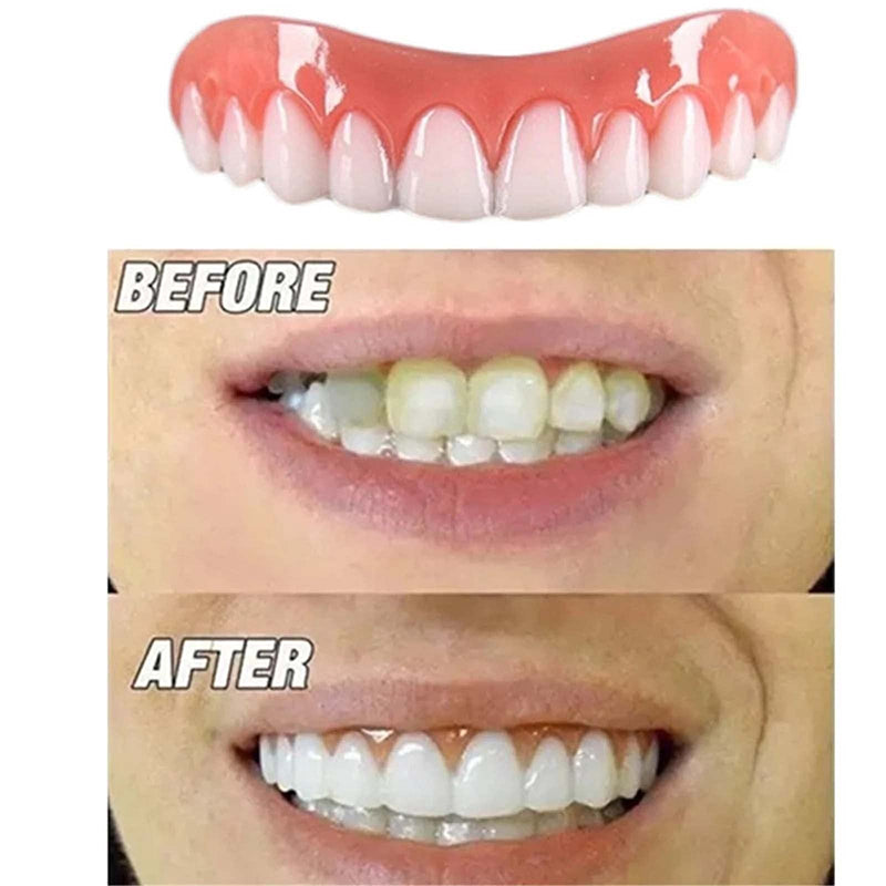 Instant Smile Denture Veneer Natural Silicone Cosmetic Upper/Lower Teeth