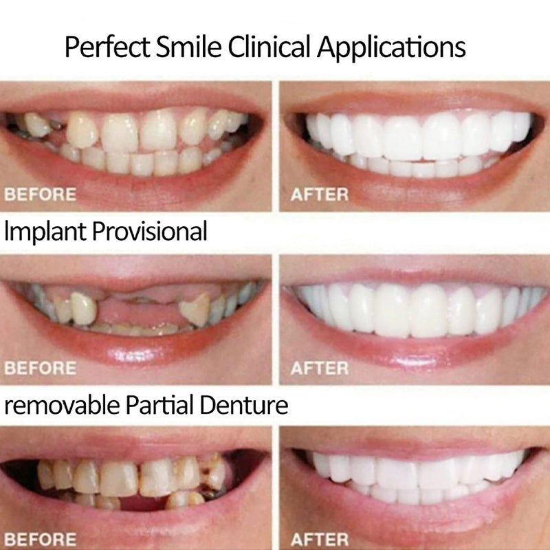 Instant Smile Denture Veneer Natural Silicone Cosmetic Upper/Lower Teeth